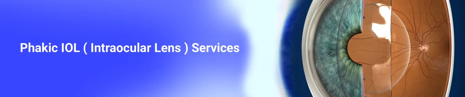 Phakic IOL ( Intraocular Lens ) Services